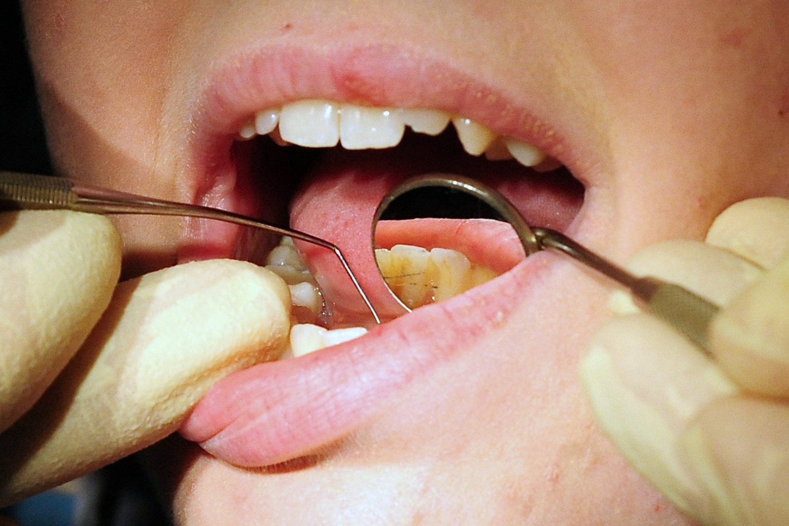 Minister challenged over plan to boost dentistry 