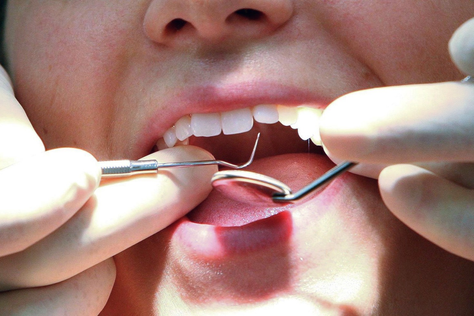 Dentists to be paid more to see urgent patients under new reforms for sector
