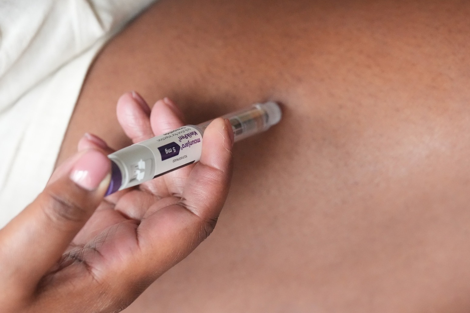 Weight loss drugs such as Mounjaro and Wegovy ‘linked to hair loss’ 