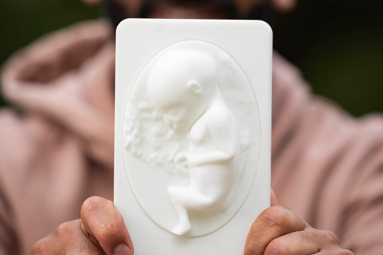 New pilot to turn ultrasounds into 3D-printed moulds for parents with sight loss