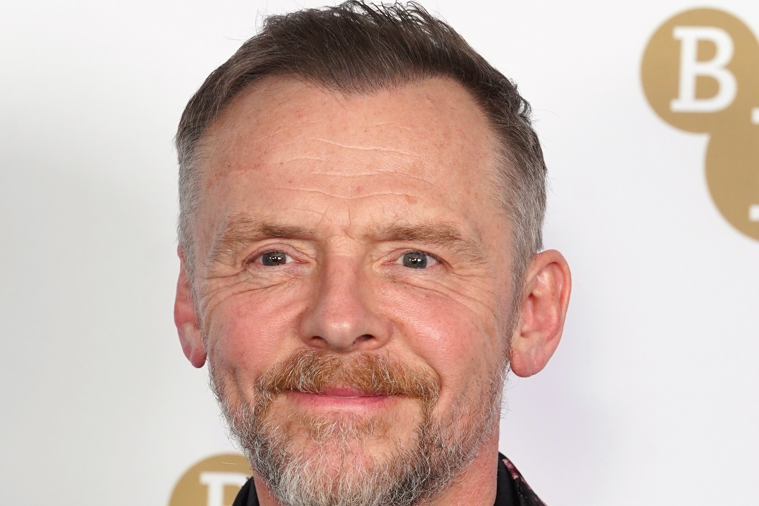 Simon Pegg reveals ADHD diagnosis: ‘It confirmed stuff I’d been wrestling with’