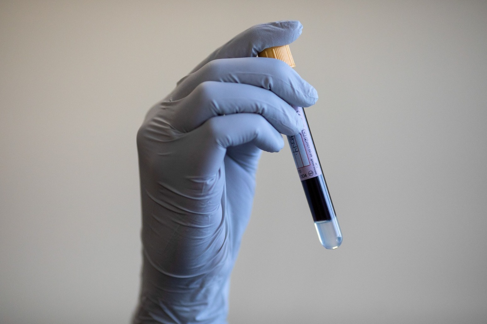 UK secures millions of blood tubes amid shortage 