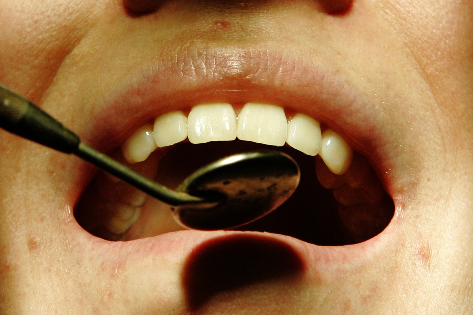 Number of ‘dental deserts’ across England growing, figures show 